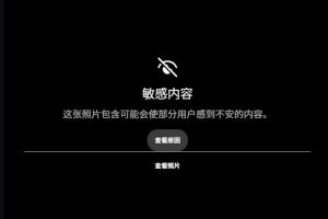 世界杯_突尼斯vs荷兰-露骨！慎入！范德彪小拇指的骨头直接刺出来了！